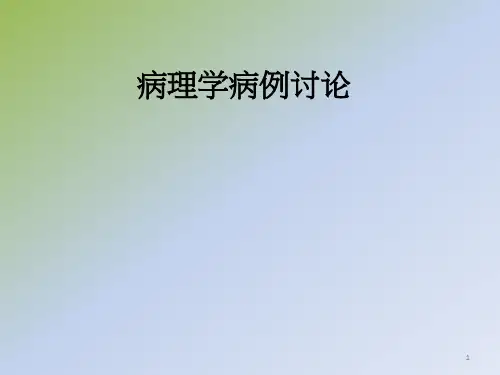 乳腺癌病例分析ppt课件
