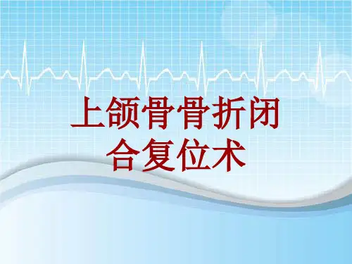 手术讲解模板：上颌骨骨折闭合复位术
