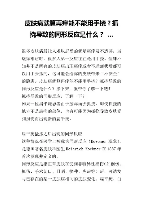 皮肤病就算再痒能不能用手挠？抓挠导致的同形反应是什么？ ...