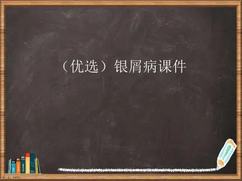 优选银屑病演示ppt