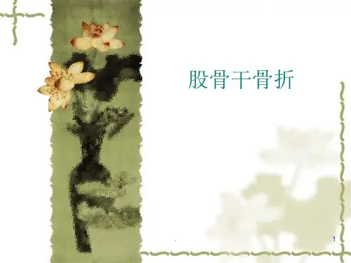 股骨干骨折ppt课件