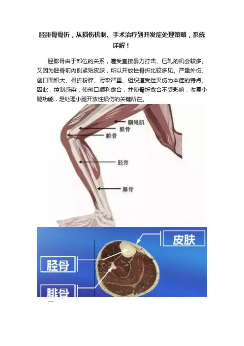 胫腓骨骨折，从损伤机制、手术治疗到并发症处理策略，系统详解！