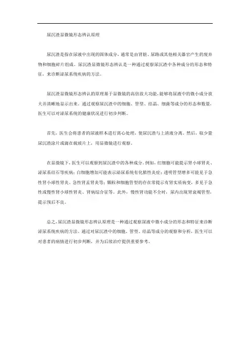 尿沉渣显微镜形态辨认原理