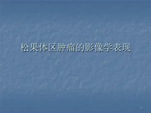 松果体区肿瘤PPT课件