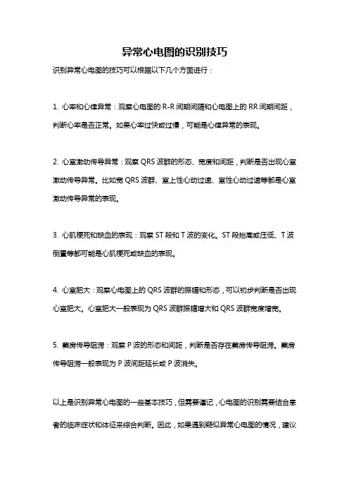 异常心电图的识别技巧