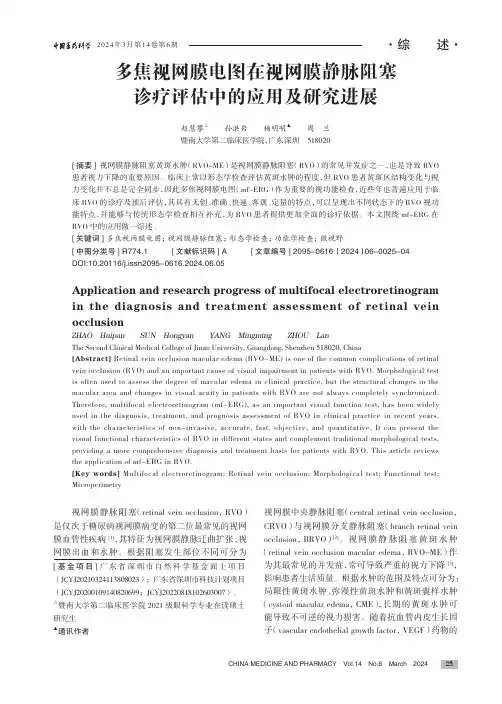 多焦视网膜电图在视网膜静脉阻塞诊疗评估中的应用及研究进展