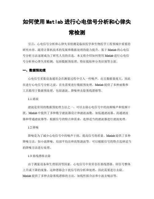 如何使用Matlab进行心电信号分析和心律失常检测