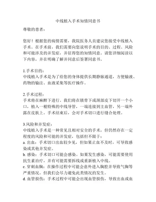 中线植入手术知情同意书