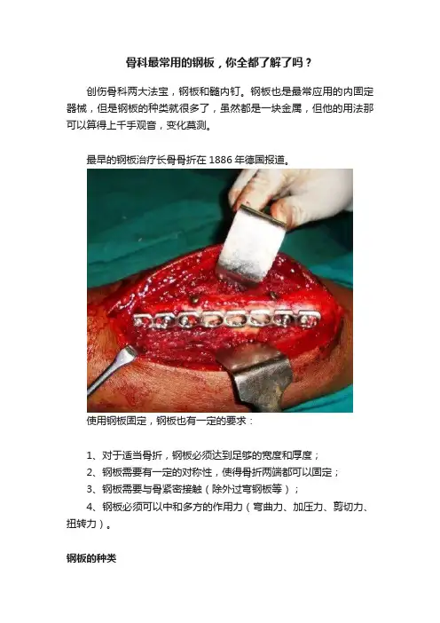 骨科最常用的钢板，你全都了解了吗？