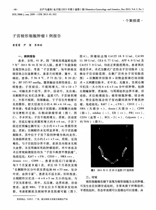 子宫梭形细胞肿瘤1例报告