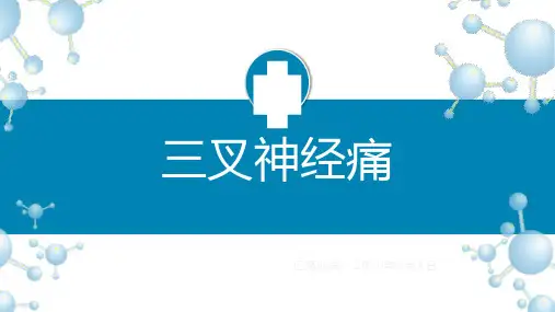 三叉神经痛