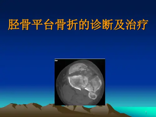 胫骨平台骨折的诊断及治疗PPT学习课件