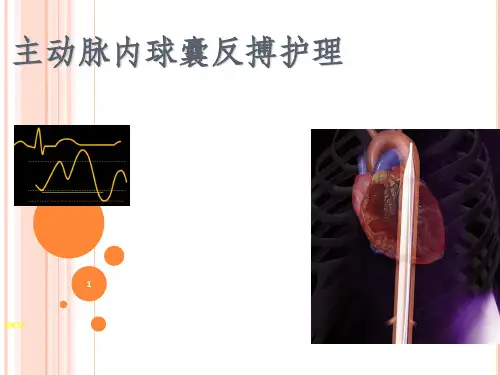 主动脉内球囊反搏术及护理ppt课件
