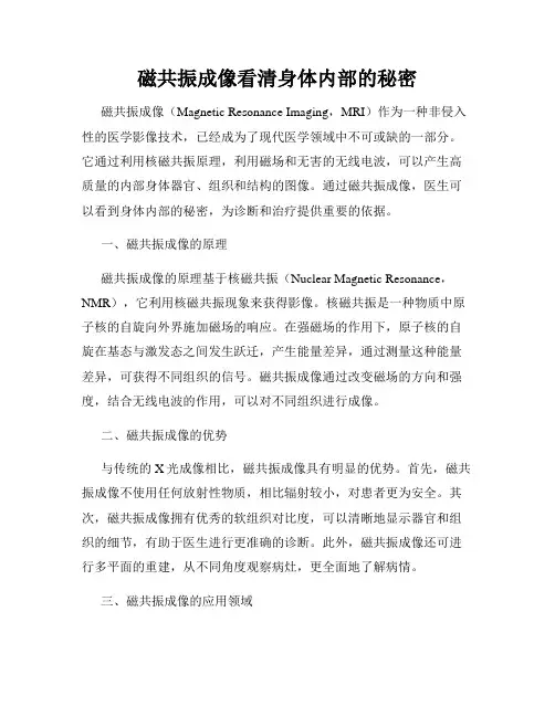 磁共振成像看清身体内部的秘密