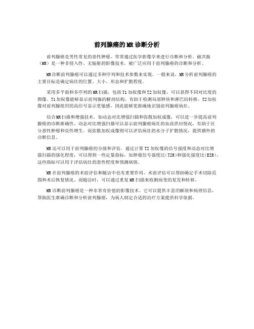 前列腺癌的MR诊断分析