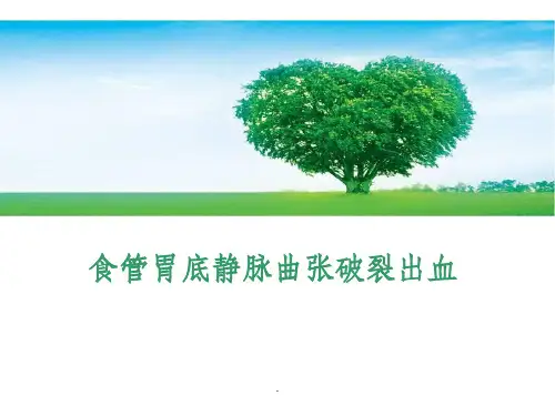 食管胃底静脉曲张ppt课件