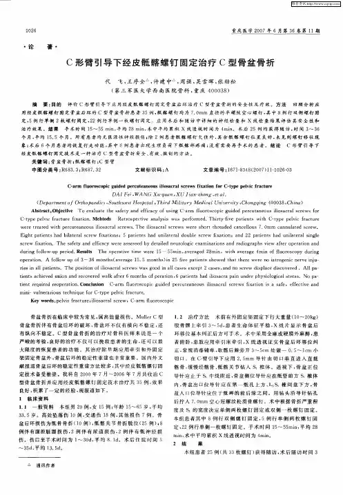 C形臂引导下经皮骶髂螺钉固定治疗C型骨盆骨折