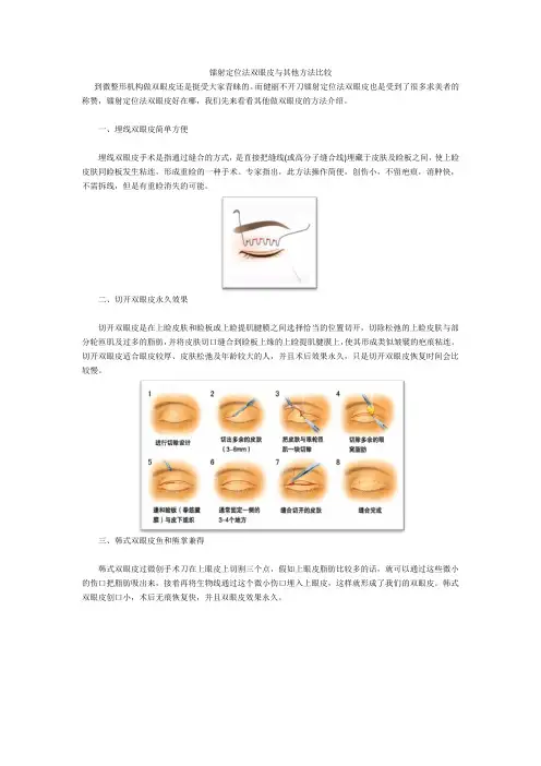 镭射定位法双眼皮与其他方法比较