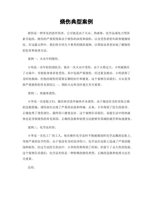烧伤典型案例