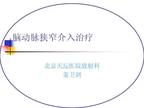脑动脉狭窄介入治疗