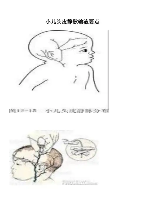 小儿头皮静脉要点讲课