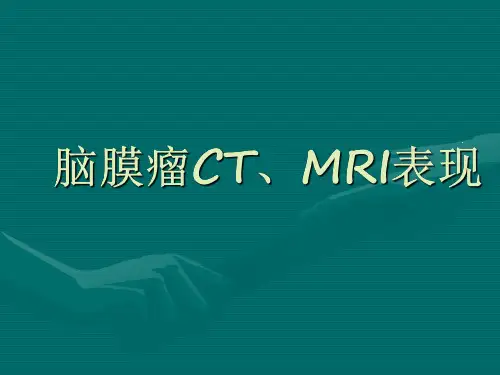 医学影像-脑膜瘤CT、MRI表现