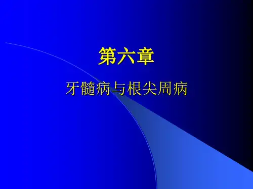 牙髓病及根尖病PPT课件