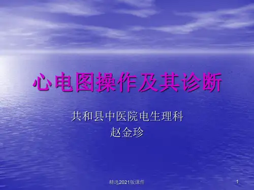 常见心脏疾病心电图诊断