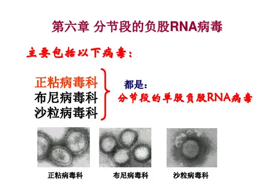 兽医微生物学-分节段的负链RNA病毒