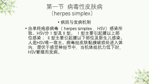 第四章病毒性皮肤病ppt课件