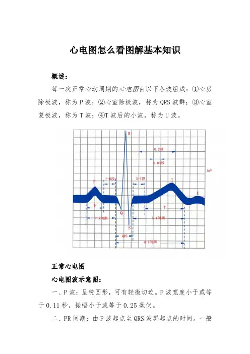 心电图怎么看图解基本知识