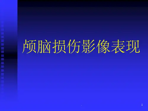 颅脑外伤影像诊断ppt课件