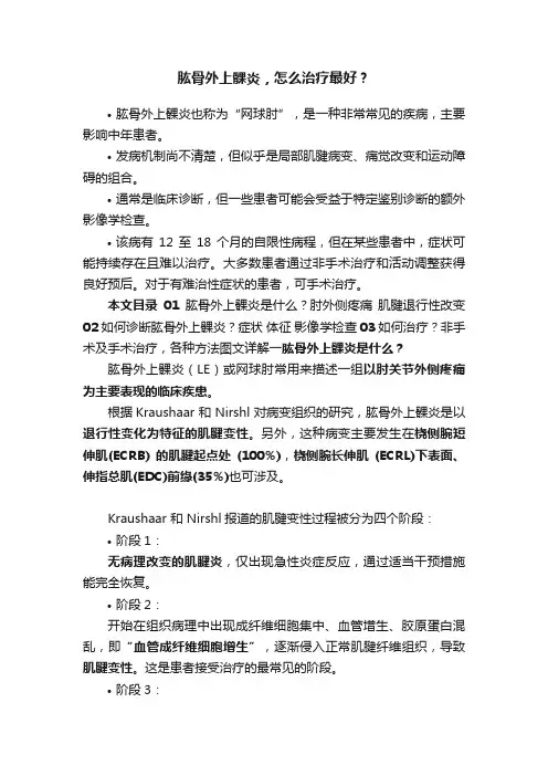 肱骨外上髁炎，怎么治疗最好？