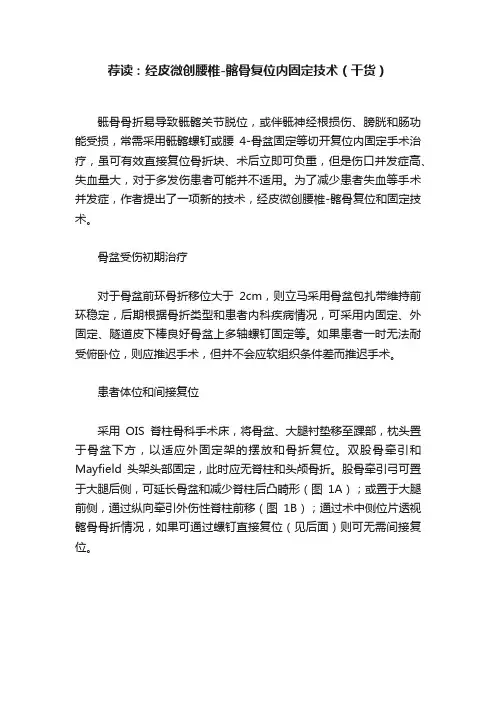 荐读：经皮微创腰椎-髂骨复位内固定技术（干货）