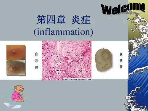 炎症(inflammation)课件