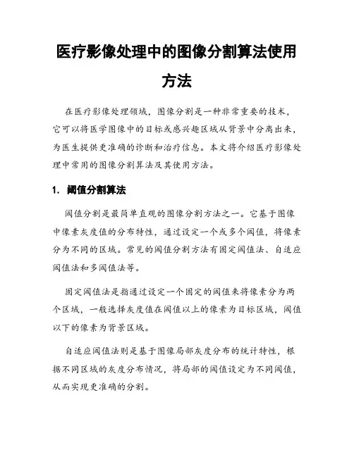 医疗影像处理中的图像分割算法使用方法