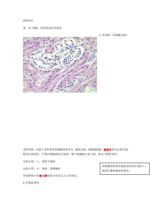 病理切片