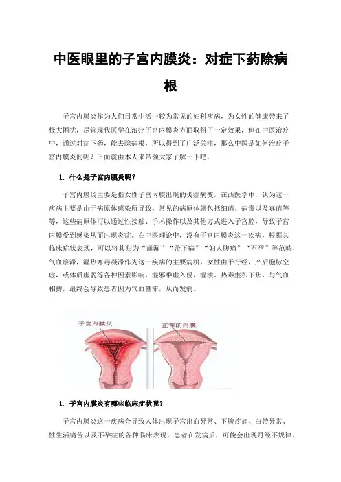 中医眼里的子宫内膜炎：对症下药除病根