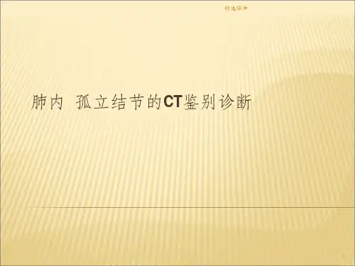 肺内 孤立结节的CT鉴别诊断