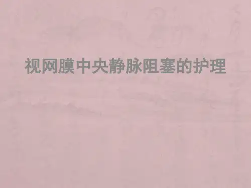 视网膜中央静脉阻塞PPTppt课件