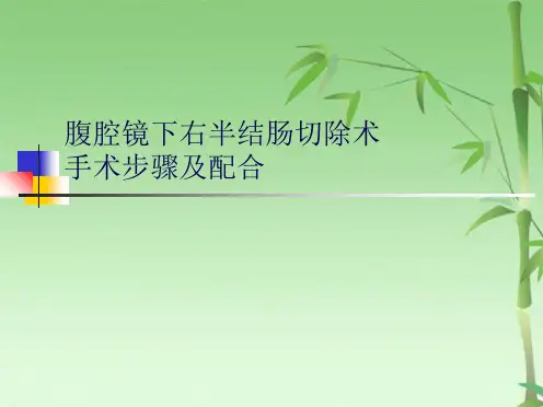 腹腔镜下右半结肠切除术(共15张PPT)