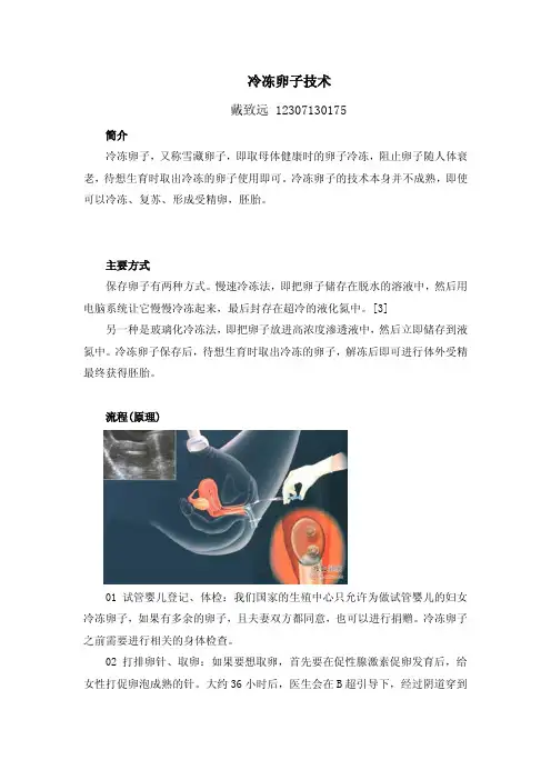 冷冻卵子技术