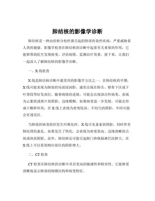 肺结核的影像学诊断