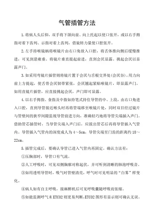 气管插管方法