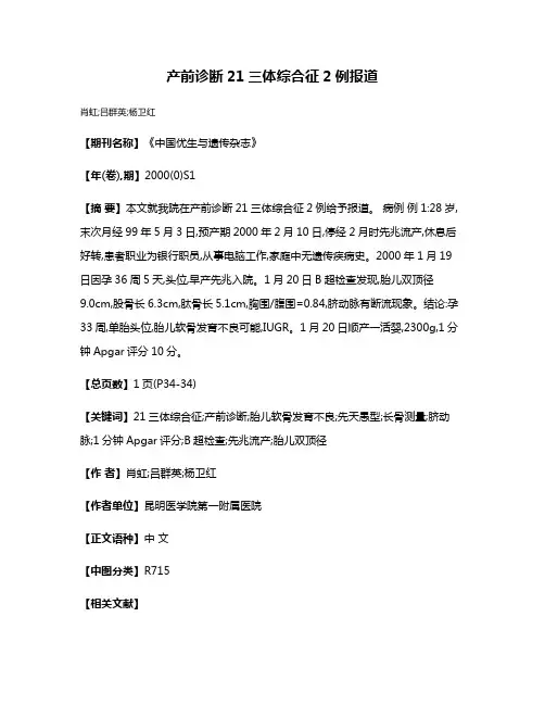 产前诊断21三体综合征2例报道