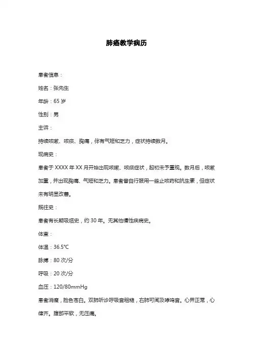 肺癌教学病历