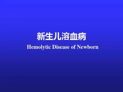 新生儿溶血病 PPT课件