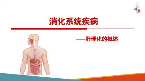 肝硬化—肝硬化概述(病理学课件)