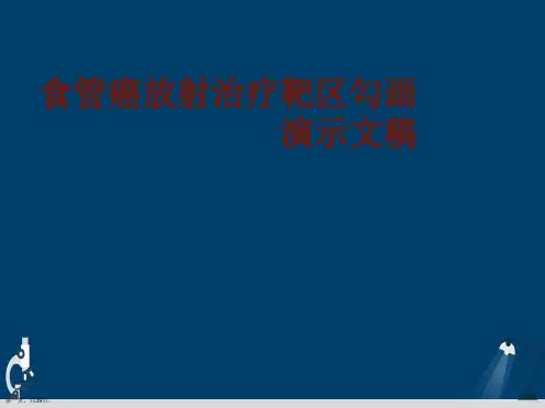 食管癌放射治疗靶区勾画演示文稿