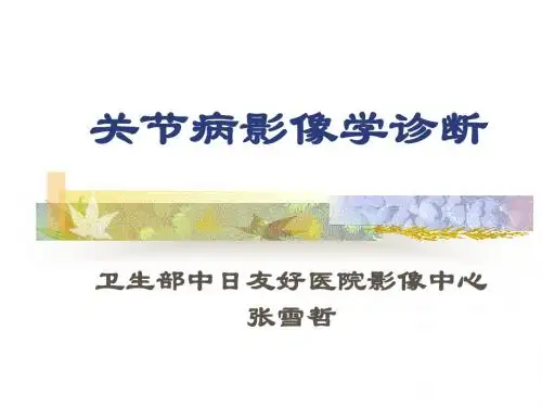 关节病影像学诊断-精选文档